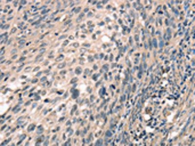 CDK12 Antibody