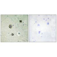 CDK5 Antibody