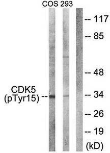 CDK5 (Phospho-Tyr15) Antibody
