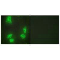 CDK5R1 Antibody