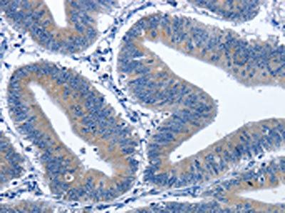 CDK5RAP3 Antibody