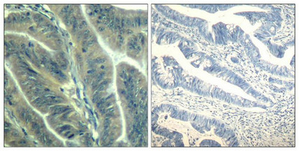 CDK6 Antibody