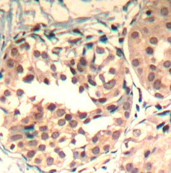 CDK6 (phospho-Tyr13) Antibody