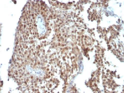 CDKN1A Antibody