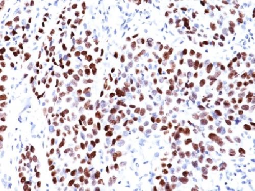 CDKN1A Antibody