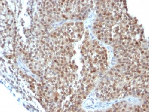 CDKN1A Antibody