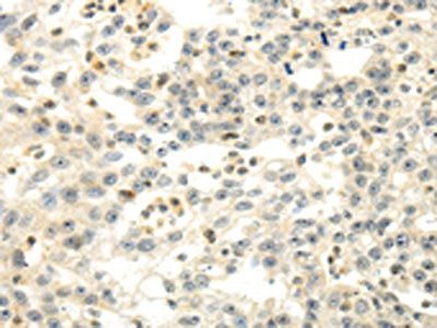 CDKN1A Antibody