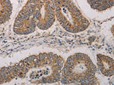 CDKN1A Antibody