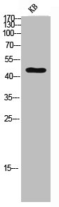 CDKN1C Antibody