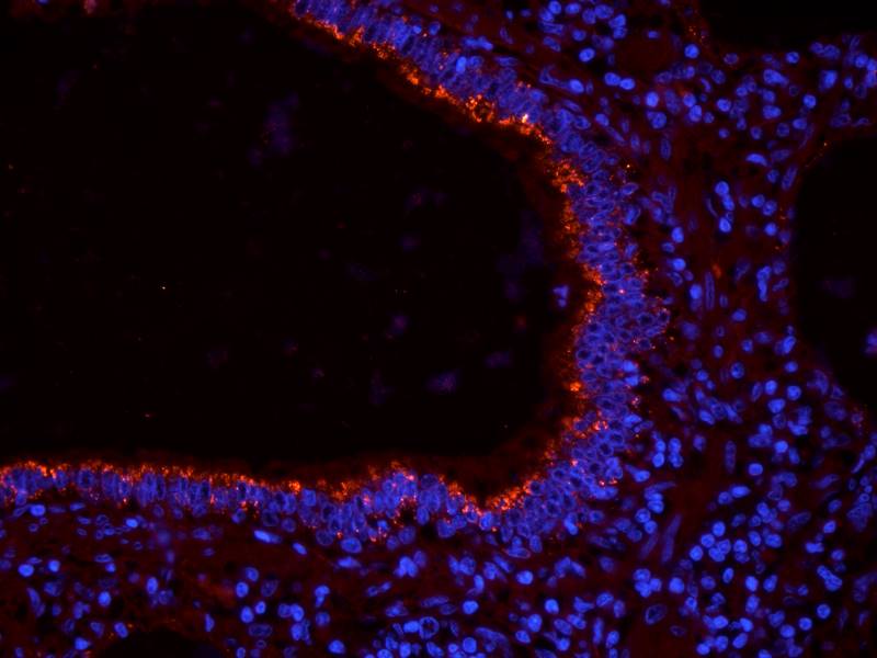 CDKN2A antibody