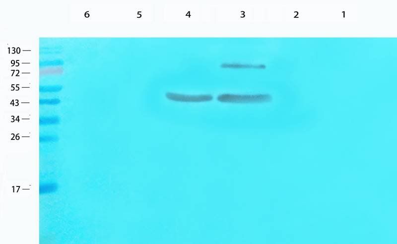 CDKN2A antibody