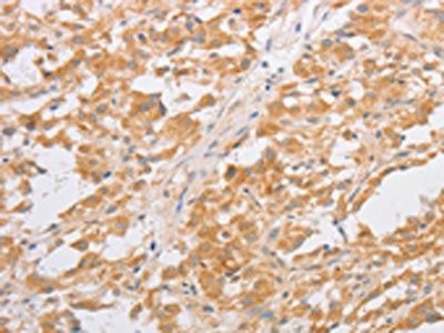 CDKN2AIP Antibody
