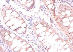 CDKN2AIPNL Antibody