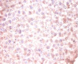 CDKN2AIPNL Antibody