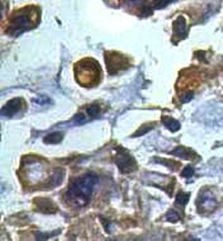 CDKN2B Rabbit Polyclonal Antibody
