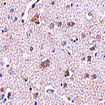 CDNF Rabbit Polyclonal Antibody