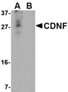 CDNF Rabbit Polyclonal Antibody