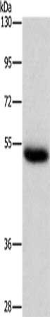 CTSC Antibody