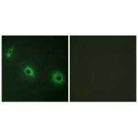 CELSR3 Antibody