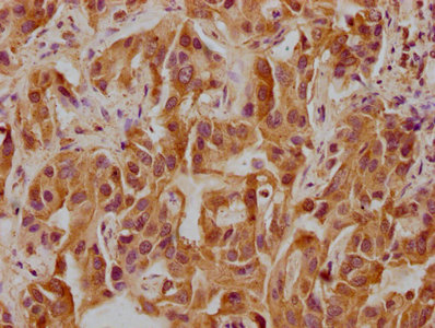 CELSR3 Antibody