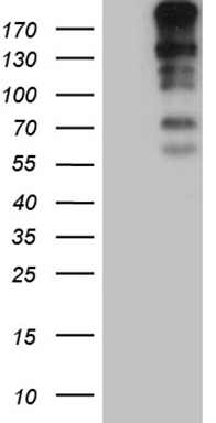 CENPJ Antibody