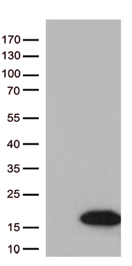 CENPJ Antibody
