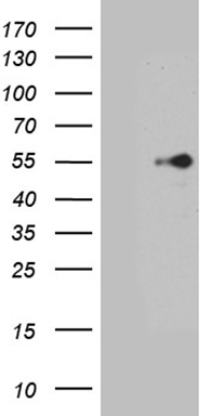 CENPQ Antibody
