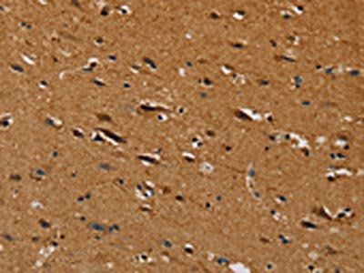 CENPU Antibody