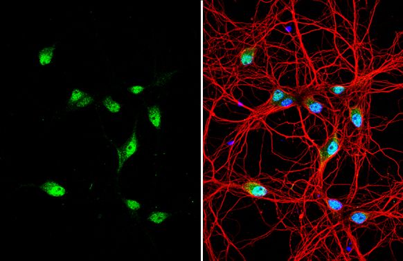 Centaurin alpha 1 Rabbit Polyclonal Antibody