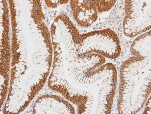 Centaurin alpha 1 Rabbit Polyclonal Antibody