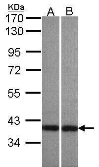 Centaurin alpha 1 Rabbit Polyclonal Antibody