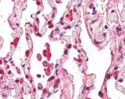 CENTB2/ACAP2 Antibody