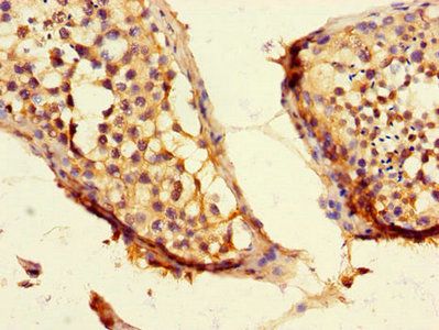 CEP192 Antibody