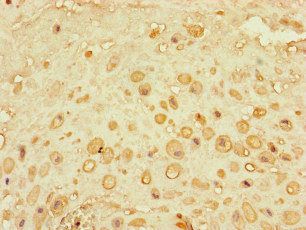 CEP290 Antibody