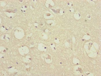 CEP57 Antibody