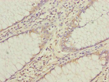 CEP95 Antibody