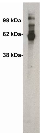 Rabbit anti Human Ceramide Kinase (rProtein-Full Length) Antibody