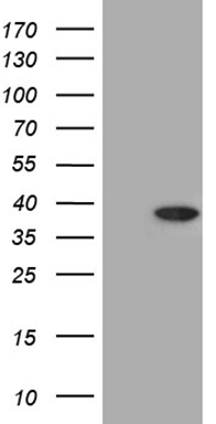 CERS2 Antibody