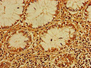 CERK Antibody