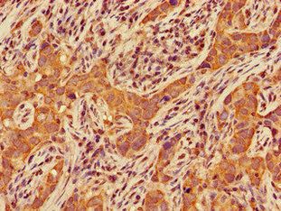 CERK Antibody