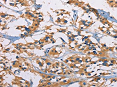 CERK Antibody