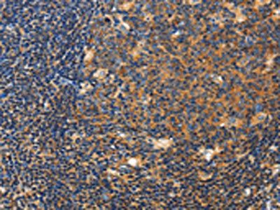 CERK Antibody