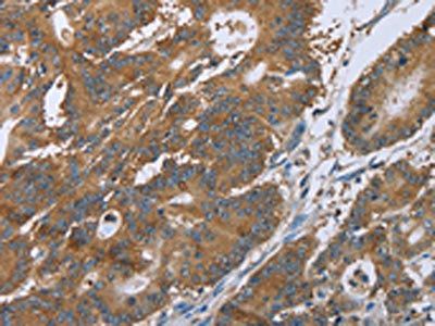 CERS4 Antibody