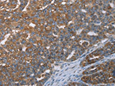CERS4 Antibody