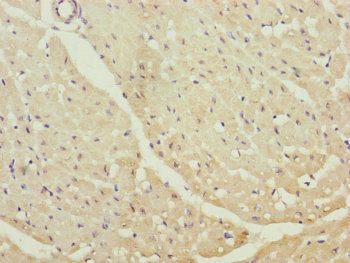 CETN1 Antibody