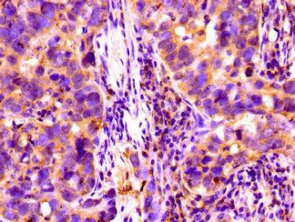 CFI Antibody