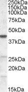 CGI58/ABHD5 Antibody