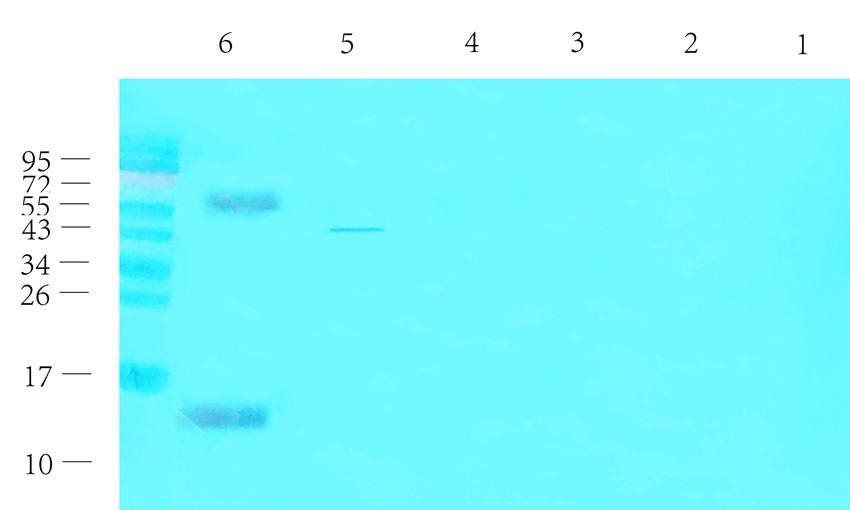 CGRP antibody