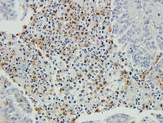 CHAT Rabbit Polyclonal Antibody