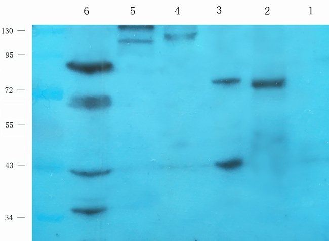 CHAT Rabbit Polyclonal Antibody